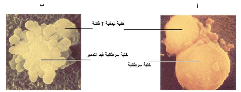 الشكل 21 -22 : دور خلايا T القاتلة في: أ) التحري عن الخلايا السرطانية واكتشافها، ب) تدميرها، كما تظهر ذلك الصور المأخوذة بواسطة المجهر الإلكتروني الماسح.