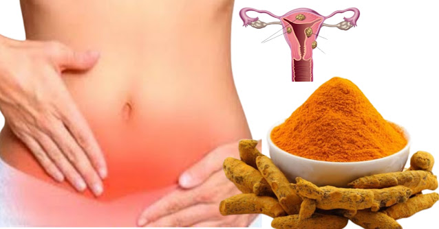 गर्भाशय में सूजन के घरेलू उपचार | bulky uterus in hindi