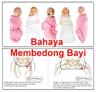 Bahaya Membedong Bayi