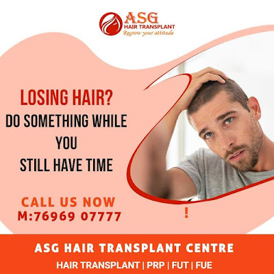 Get Hair Transplant in Punjab