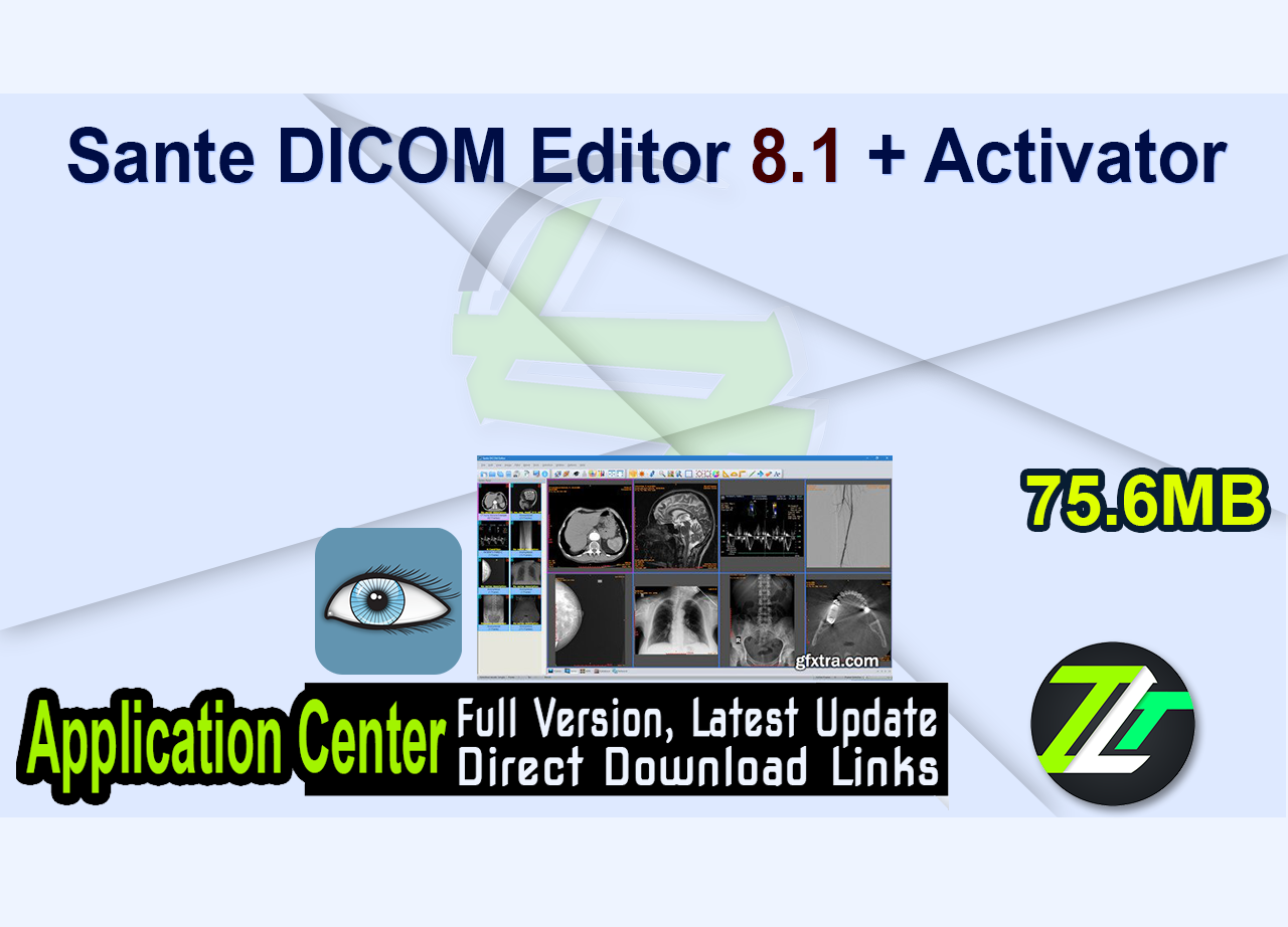Sante DICOM Editor 8.1 + Activator