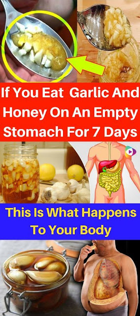 If You Eat Garlic And Honey On An Empty Stomach For 7 Days, This Is What Happens To Your Body
