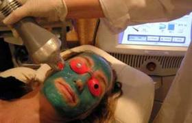 Fraxel Laser Treatment For Remove Scars