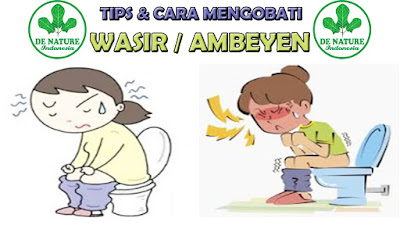 Obat Wasir Herbal Masa Kini