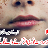 How To Get Rid Of Black Spot - Home Remedies