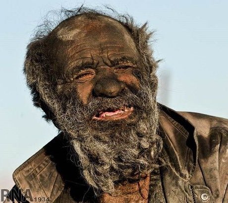 World Dirtiest Man 94 वर्षीय " गंदे "आदमी की कहानी जानकर हो जाएंगे हैरान..