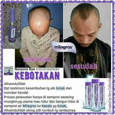 √ Harga Milagros di Cawang ⭐ ✅ WhatsApp 0813 2757 0786