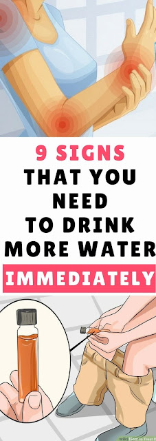 9 Signs that You Need to Drink More Water Immediately