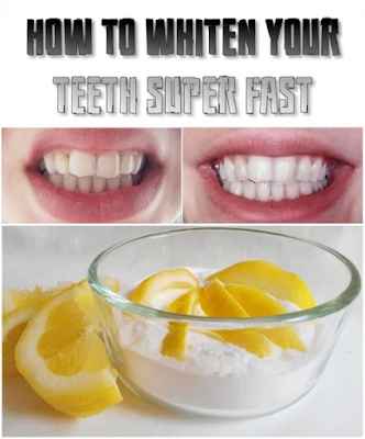 How to whiten your teeth super fast