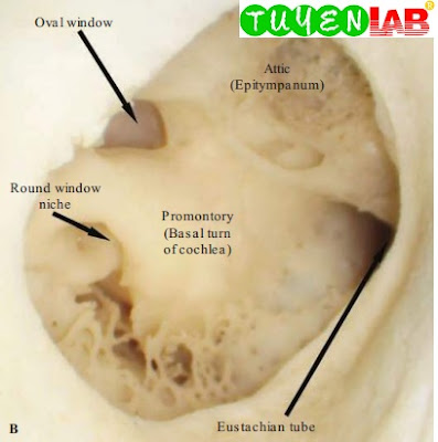 Normal bony landmarks of the inner ear