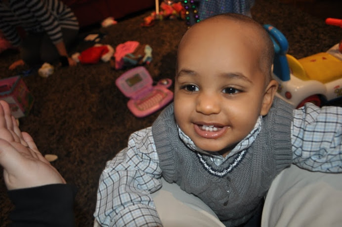 Me and My New Bald Head