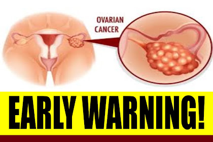 7 Signs of Ovarian Cancer You Might Be Ignoring