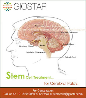 Stem Cell Therapy for Cerebral Palsy