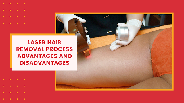 Laser Hair Removal Process Advantages and Disadvantages