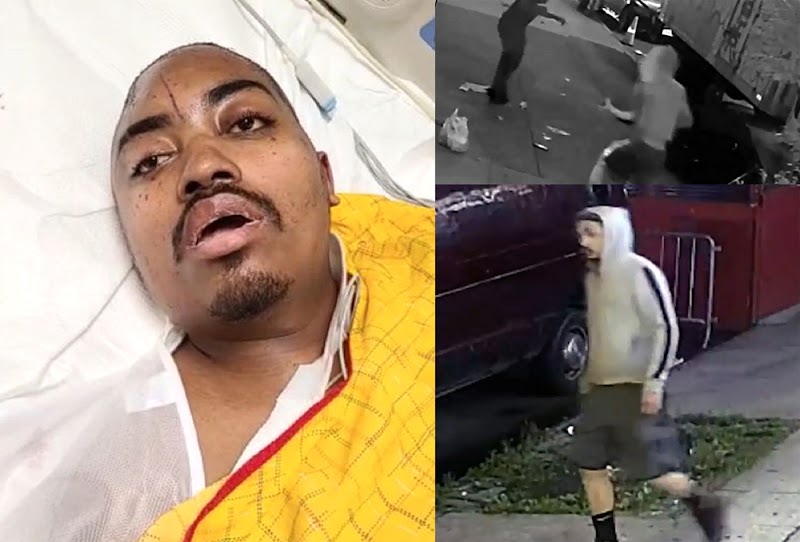  Un dominicano grave después de ser emboscado y golpeado  en calle de El Bronx con bloques de adoquines 