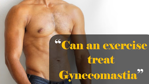 Can an exercise treat Gynecomastia, Gynecomastia, treatment of gynecomastia