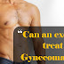 Can an exercise treat Gynecomastia? : Gynecomastia