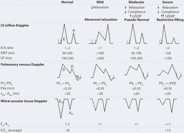 echocardiography: Left ventricular diastolic function