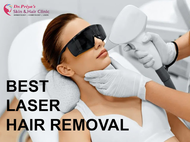 Best Laser Hair Removal In Bangalore