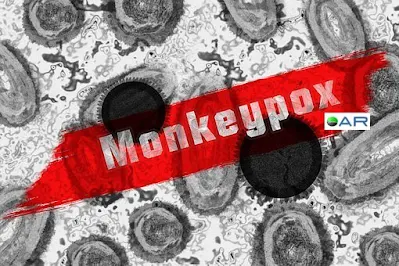 monkeypox