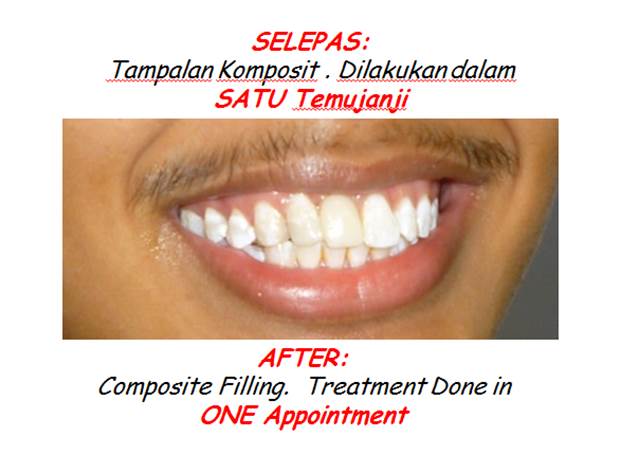 Dentist Shah Alam Seksyen 9 - Soalan 33