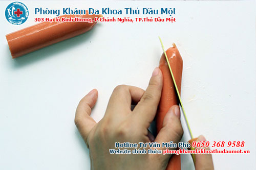 Cắt bao quy đầu xong, cần vệ sinh như thế nào