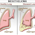 Mesothelioma Legal Lawsuit - How to Get Compensation For Mesothelioma