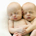 FACTS ABOUT TWINS 