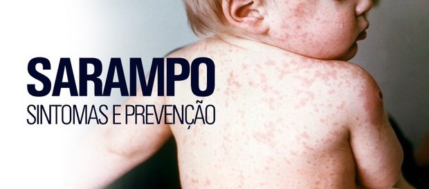 Sarampo: saiba mais sobre a doença por trás de surtos no Brasil