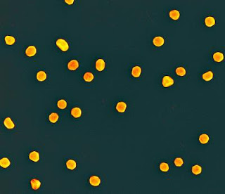 SEM Image of Gold Nanoparticles