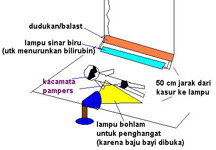 cara merawat bayi kuning