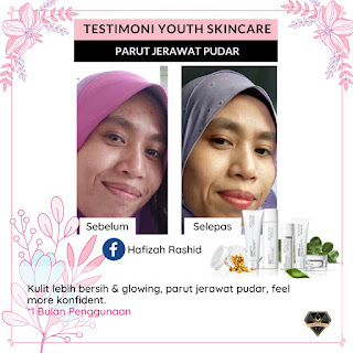 Harga YOUTH Shaklee, Review Pengguna Youth Skincare, Skincare, YOUTH Skincare Shaklee, qiya beauty, qiya saad, pengedar shaklee klang, shaklee bandar putera 2 klang, shaklee shah alam, set penjagaan kulit, cara hilangkan jerawat pasir jerawat batu, pudarkan parut, pencuci muka organik, toner wajah, pelembab wajah, krim pelindung matahari, SPF, sun protection, masalah kulit wajah, licinkan kulit, putihkan kulit muka, rawatan muka, facial cleanser, pencuci muka, serum untuk kulit cantik, tona kulit tak sekata, pigmentasi, kesan hormon tak seimbang, testimoni youth skincare shaklee, polifenol untuk kulit wajah cantik awet muda,