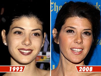  and whether or not she has underwent any plastic surgery procedures