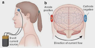 http://www.nature.com/npp/journal/v35/n1/full/npp200987a.html#fig5