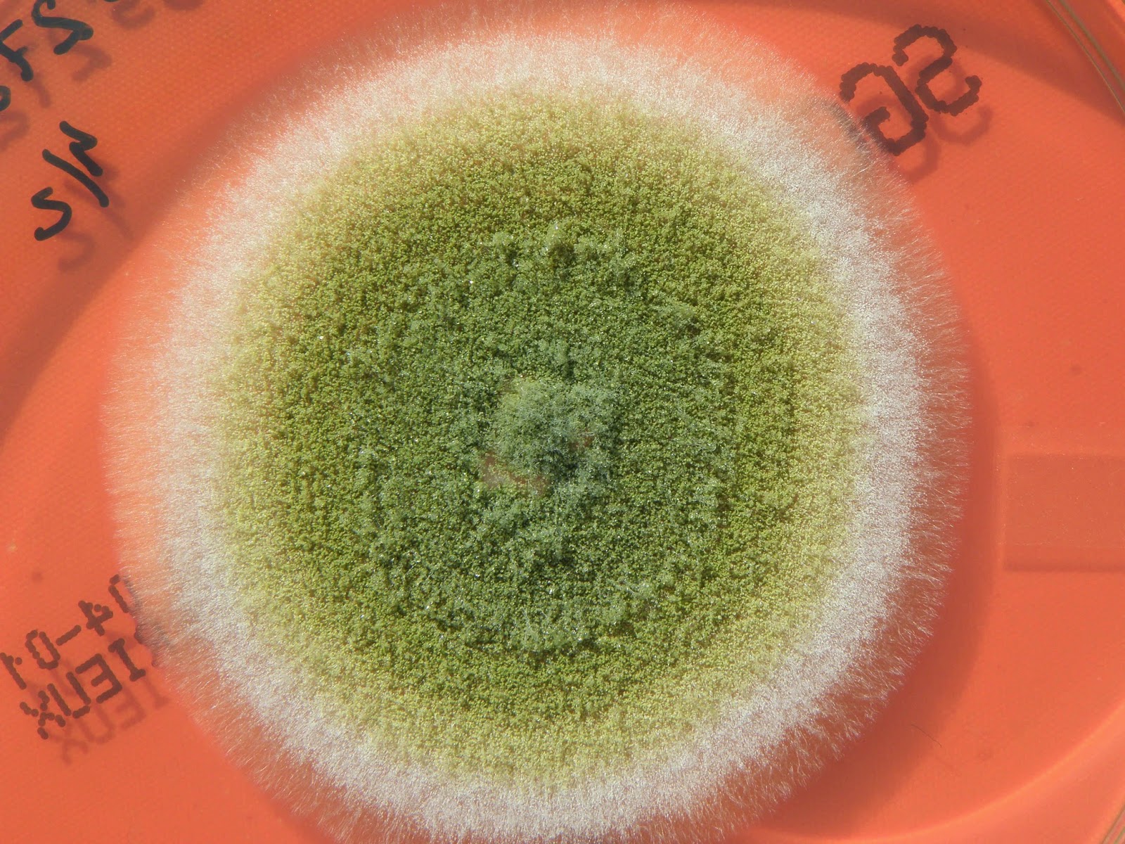 ATLAS MICOLOGIA: ASPERGILLUS FLAVUS