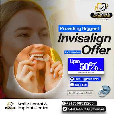 Invisalign Treatment in Hyderabad