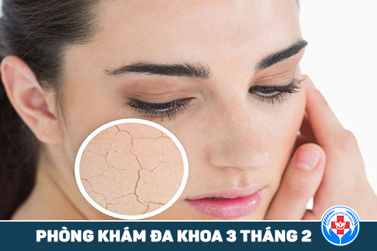 Làm thế nào để điều trị da của bạn vào mùa đông?