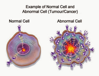 Obat Tumor ini AMPUH Obati Semua Jenis Tumor Tanpa Operasi