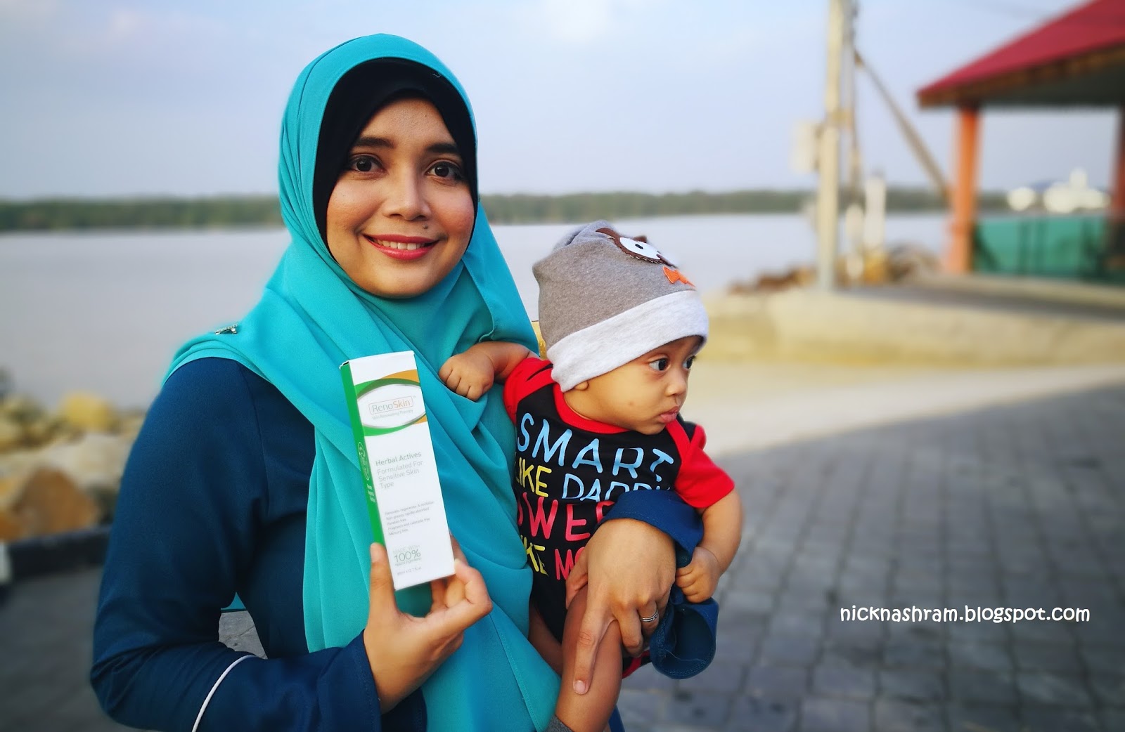 RenoSkin Medic Serum Penawar Untuk Eczema Dan Masalah 