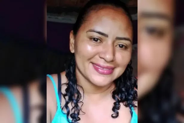 Mulher morre no hospital após queimaduras de 2º grau em Cacoal; marido é apontado como suspeito