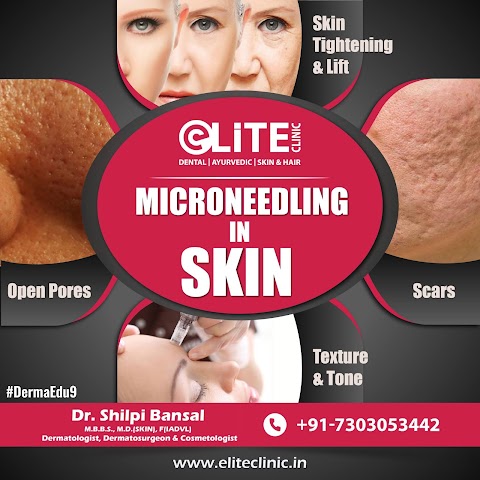 Micro needling in Skin - Social Media Post