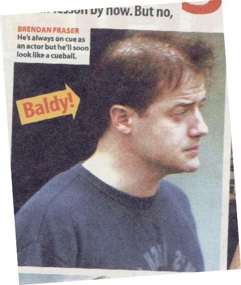 brendan fraser fat. Bad Hair