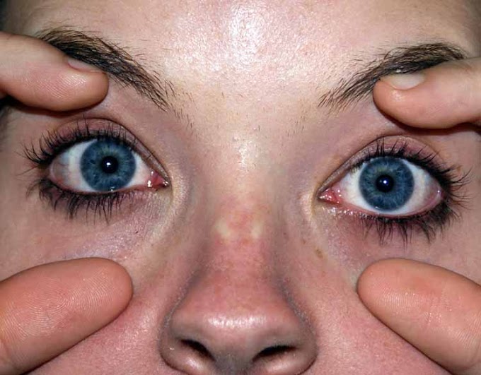 Abre os olhos!