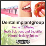 Dental Implants London