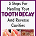 5 Steps For Healing Your Tooth decay And Reverse Cavities