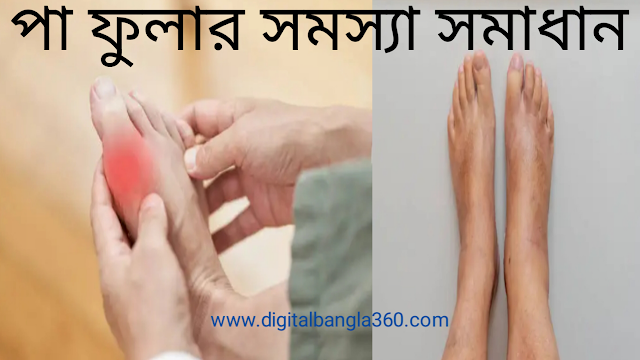 পা ফোলার সমস্যা হলে কী কী পরীক্ষা করানো যেতে পারে? | Online health in Bangla