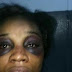 Exclusive photos: Husband beats and stabs his wife in her private part after accusing her of cheating