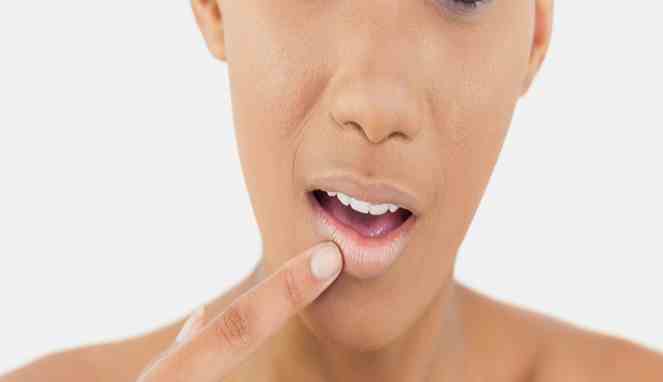Penyebab Bibir Hitam dan 6 Cara Mengatasinya Secara Alami