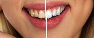 7 Cara Utama untuk Merawat Kesehatan Gigi dan Mulut