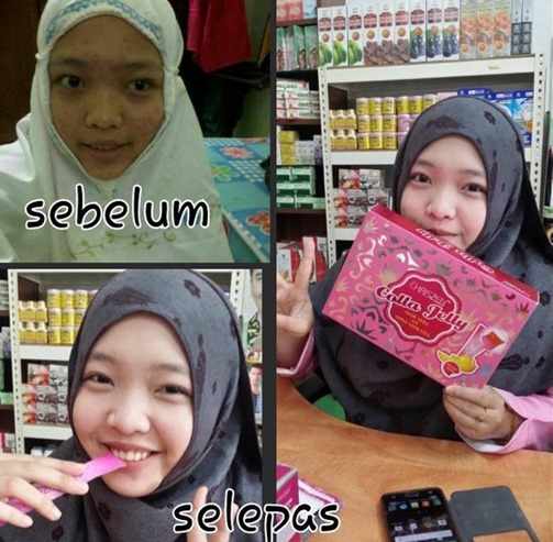 colla jelly chriszen testimoni